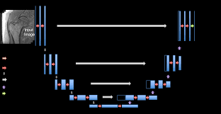Some artifacts affect the quality of the mri exam while others do not affect the diagnostic quality but may be confused with pathology. Https Arxiv Org Pdf 1704 06176