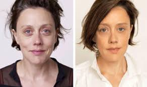 Is plastic surgery really worth the pain and money?