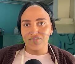 Su hijo de 6 estaba jugando con los primitos en la calle cuando le pasaron  dos de frente y miren lo que le hicieron. Ahora su hijo, no puede ver de un