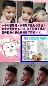 小家伙不小心被绊倒 头额随即鼓起一粒小笼包 幸好家里有妈妈们的必备宝物 agigi 分别下午与晚上各涂了一次 只涂了两次喔 隔天一大清早小笼包消了很多啦 prolabsenseagigi 家里必备宝物想要了解更多 请联系我 ulcers movies movie posters