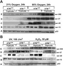 It first aired on may 8, 2004. Hyperoxia Activates The Atr Chk1 Pathway And Phosphorylates P53 At Multiple Sites American Journal Of Physiology Lung Cellular And Molecular Physiology