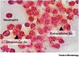 Image result for Neisseriaceae