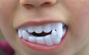 There's a wide variety of fangs you can get. Non Candy Treats For A Healthier Halloween Yakima Dentist Bradley Tew D D S