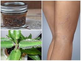 Venen an händen stark sichtbar – Der beste Tag