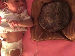 Lotus Birth What Is It And What Does It Do Madeformums
