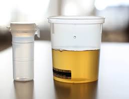 1) click the button below. Drug Screening For Employers Quest Diagnostics Regulated Urine Testing