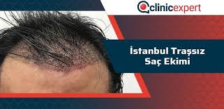 Istanbul Tirassiz Sac Ekimi Clinicexpert Uluslararasi Saglik Hizmetleri