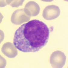 Pdf Automated Flagging Influences The Inconsistency And Bias Of Band Cell And Atypical Lymphocyte Morphological Differentials