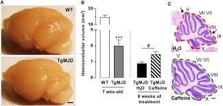 Machado Joseph Disease Transgenic Tgmjd Mice Display Cerebellar Download Scientific Diagram