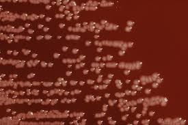 Image result for yersinia fotos