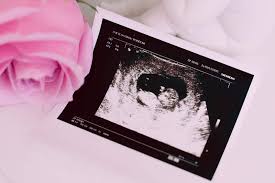 Wie Du Schon Beim Ersten Ultraschall Das Geschlecht Deines Babys Erfahren Kannst Faminino