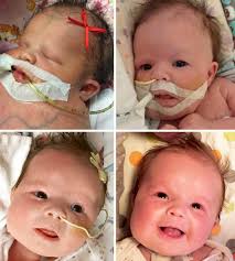 Please Help Baby LoLo