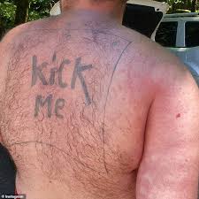 Julianna zobrist began her music career a year after graduating college. Top Surgeon Wants Ban On Drunk Tattoos And Demands Customers Sign Waiver Daily Mail Online