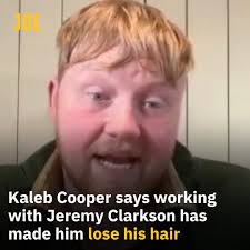 My hairline's getting worse' 😅