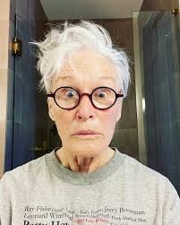 76-Year-Old Glenn Close Shocks Fans With Bruised Face In New Photo