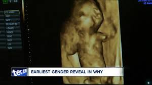 But in those weeks leading up a baby's gender is anyone's guess. Boy Or Girl The Earliest Gender Reveal Available In Western New York