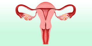 Post Tubal Ligation Syndrome Women Discuss Side Effects Of Getting Tubes Tied
