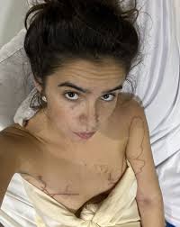 Aussie Woman's Close Call With a Box Jellyfish in Thailand