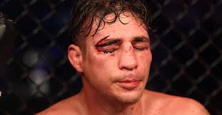 Diego sanchez split with his coach and manager joshua fabia last week and now fabia has spoken out about the ufc hall of famer. My Soul Has Been Raped Many Times Diego Sanchez Chimes Post Combat Trauma Mma Sports Jioforme