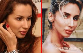 Светлана лобода прокомментировала скандал между нателлой крапивиной помнится она пела в группе виагра, но костя меладзе турнул ее быстро из группы. Arhivnye Foto Svetlany Lobody Do Plastiki Popali V Set