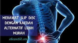 It usually gets better slowly with rest, gentle exercise and painkillers. Rawatan Slip Disc Alternatif Dengan Kos Lebih Murah Ohcantik Com