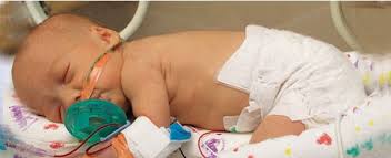 Pin On Premature Baby Pacifiers