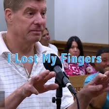 I Lost My Fingers