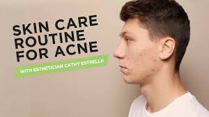 Skin Care Routine for Acne with Esthetician Cathy Estrella