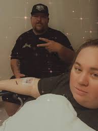 Incisonal Hernia Surgery Recovery