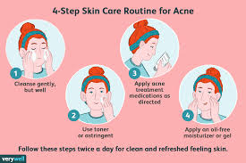 the best skin care routine for acne