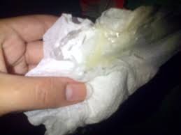 Tapon Mucuoso Nose Ayudaaa Bebes De Abril 2015 Babycenter