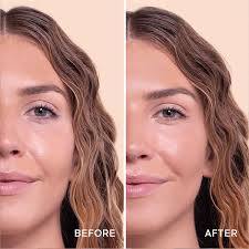 Got Tiny Bumps On Your Forehead? Try This