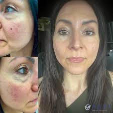 Janine Tedesco PA-C • Aesthetic injector • Stamford, CT  (@pureinjector_janine) · Instagram photos and Reels