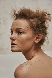 beauty freckles, SModa by Daniel Scheel