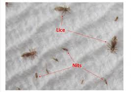 Image result for lice vs nits