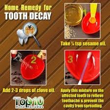 Tooth Decay And Cavities Home Remedies And Prevention Tips Top 10 Home Remedies Tooth Decay Remedies Cure Tooth Decay Tooth Decay
