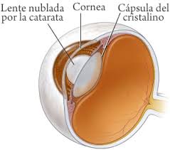 Check spelling or type a new query. Cataratas En Los Ojos