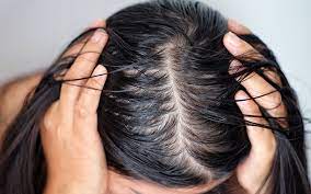 Oily Scalp With Dry Ends: Why & How To Control? – Skinkraft