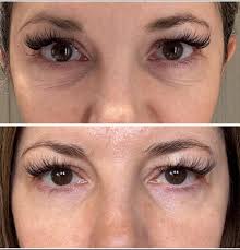 🚨 AVAILABLE TODAY