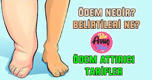 Odem Nedir Neden Olur Ibrahim Saracoglu Odem Attiran Kuru Biravucbilgi Com Odem Memes Digital