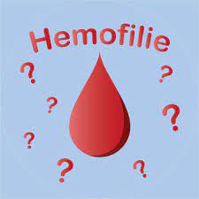 Toate tipurile de hemofilie se caracterizeaza prin tendinta la sangerare sau hemoragie. Hemofilie Home Facebook