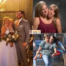 I refuse to be the only one having several thoughts running through my  mind. These are conjoined twins, Abby and Brittany Hensel, each of them has  their own head, heart, stomach, lungs,
