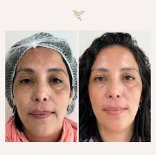 Dra. Bárbara Cortés (@dra.barbaracortes) • Instagram photos and videos