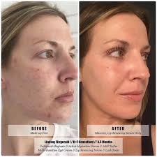 Rodan + Fields: Natalie Brandt- Independent Consultant