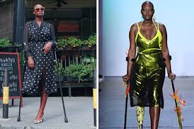 One leg tryna walk in my. Mama Cax The Trailblazing Model Who Strutted Runways With Her Prosthetic Leg Has Died