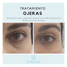 Check spelling or type a new query. Clinica Baron De Carcer Photos Facebook