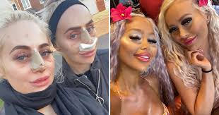 Des jumelles fans de Barbie déboursent des milliers d'euros pour ressembler  à leur idole