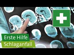 Erste Hilfe Bei Schlaganfall Youtube