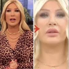 Seda sayan'ın son hali 5 gün önce instagram hesabından estetik yaptırırken videosunu yayınlayan seda sayan'dan yeni fotoğraf geldi. Seda Sayan In Yuzune Ne Oldugu Ortaya Cikti Magazinci Com