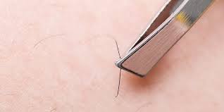 When deciding the best way to remove pubic hair as a male, there's a couple of factors you will need to. How To Get Rid Of Ingrown Hairs At Home